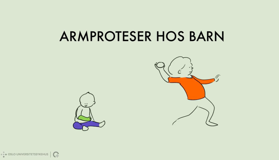 Ny informasjonsfilm: Armproteser hos barn